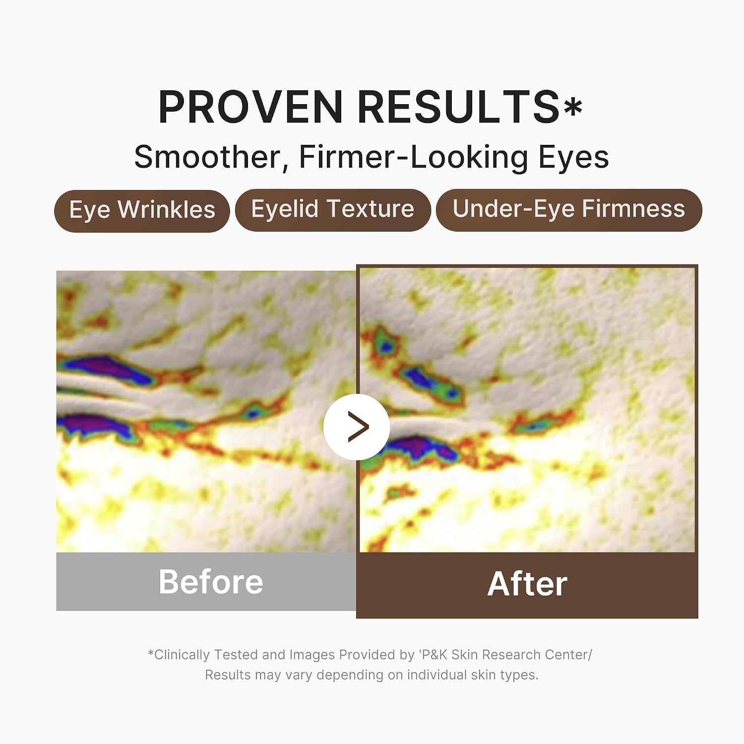 Eye Serum with Deep Reviving Peptide | Eye Treatment Serum with Multi Peptides, Niacinamide & Squalane | Reduces Signs of Aging and Fine Lines | Korean Skincare, 1.01 Fl.Oz